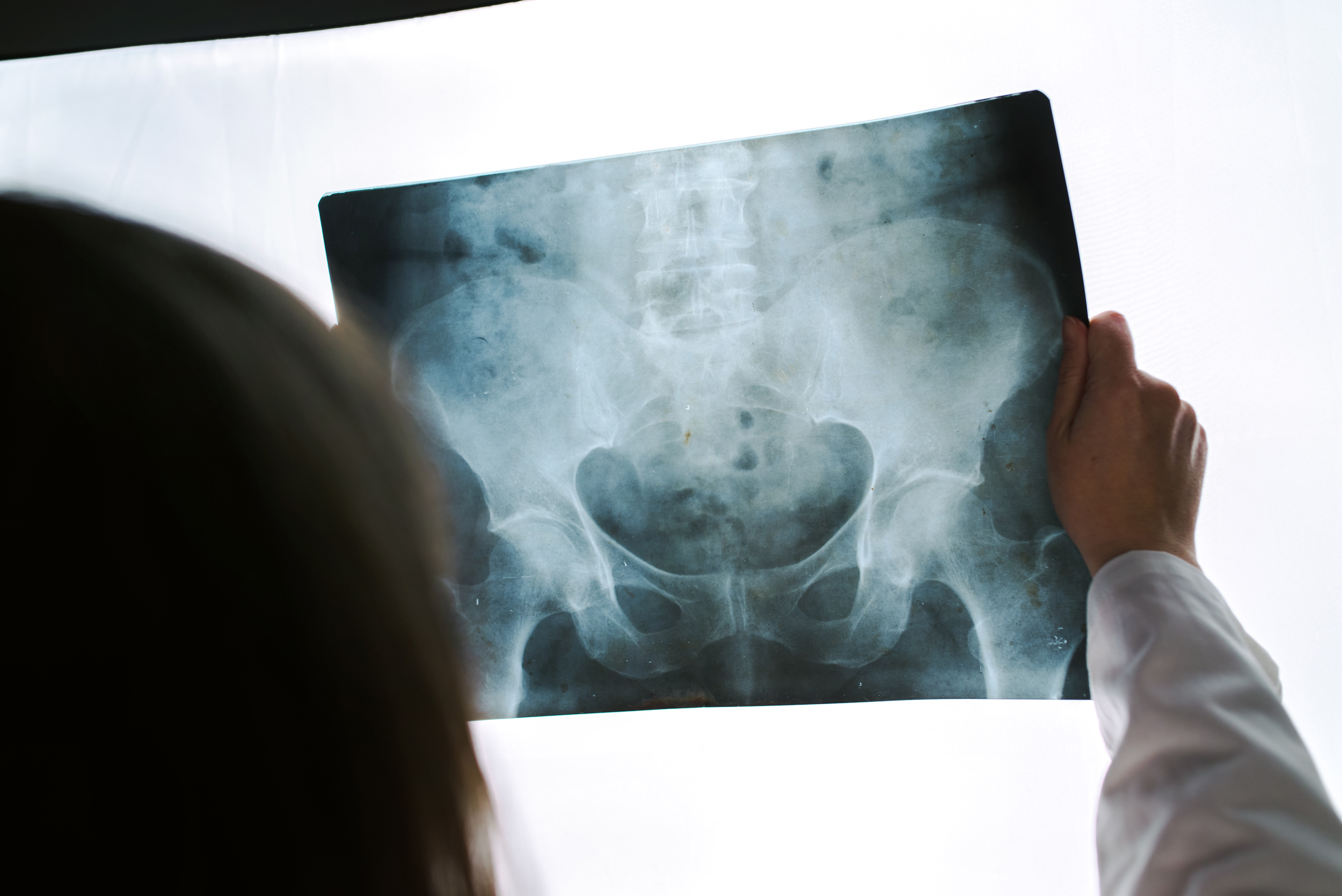female doctor examining pelvis x-ray in hospital