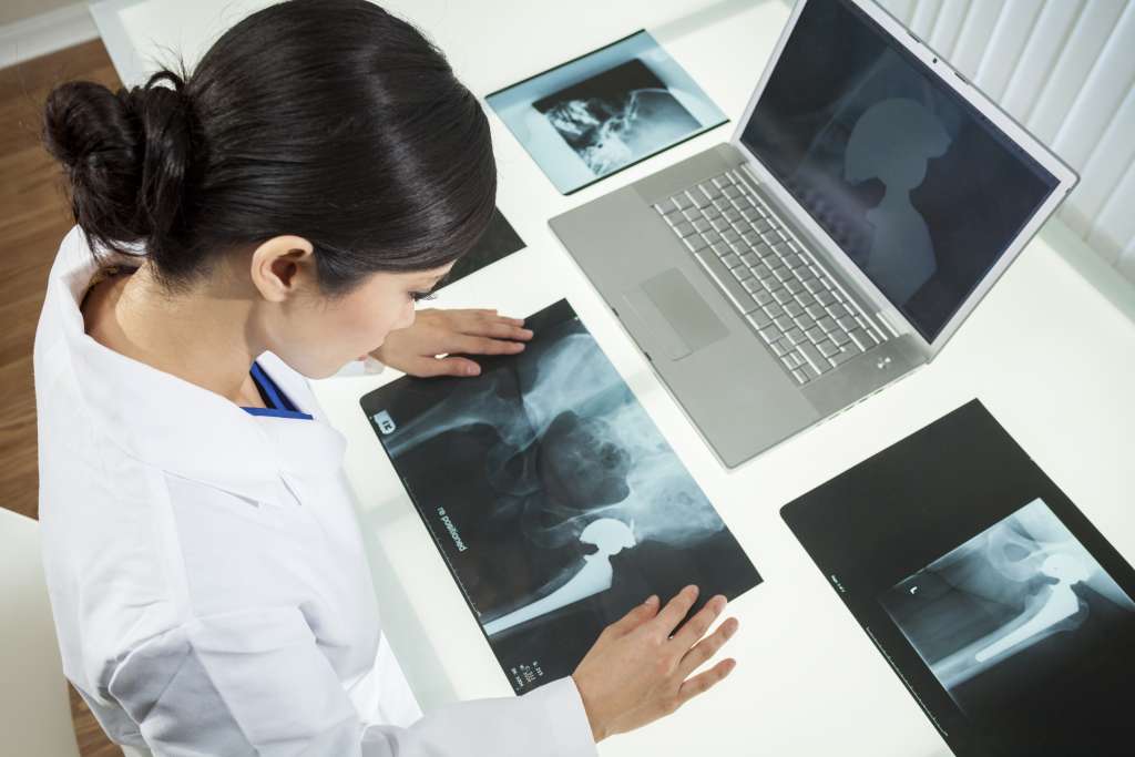 young woman doctor looking at hip replacement xrays