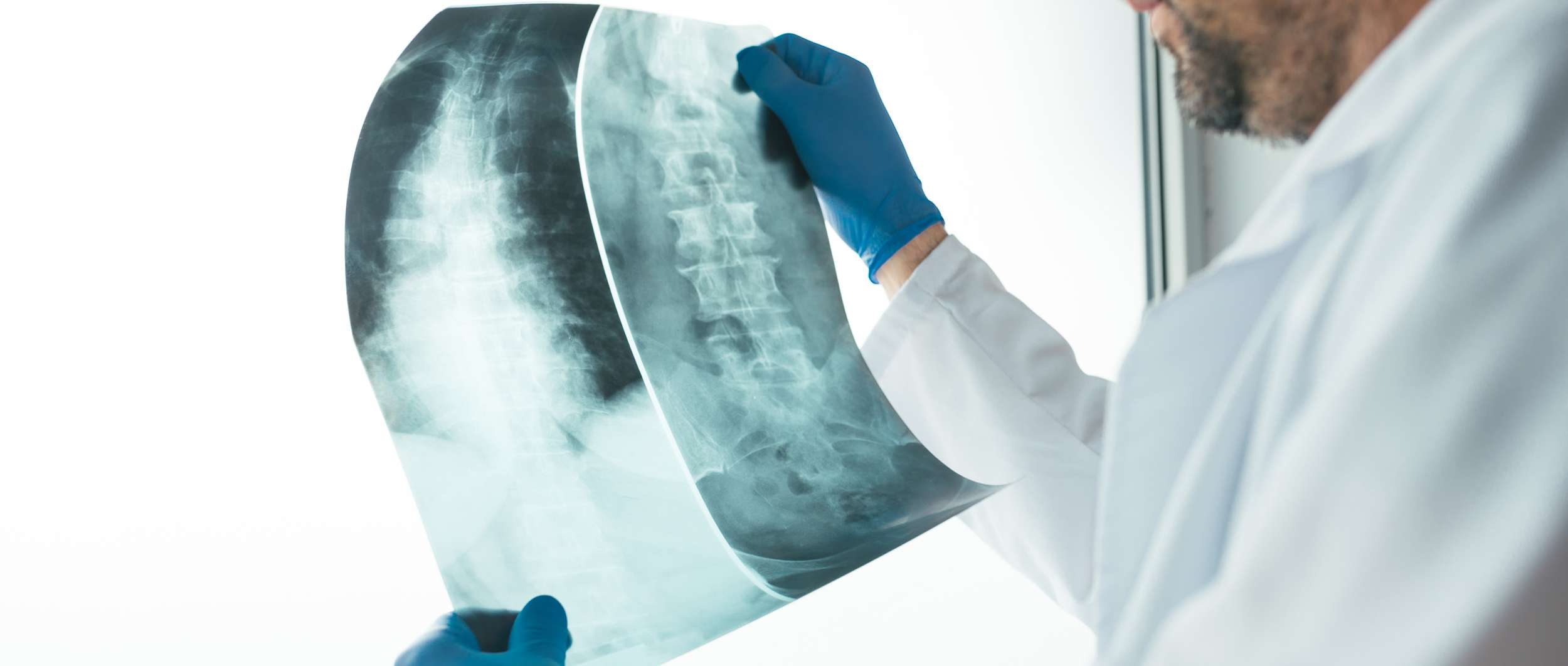 doctor examining x-ray of the human spine