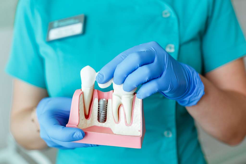 Dentist showing tooth implant