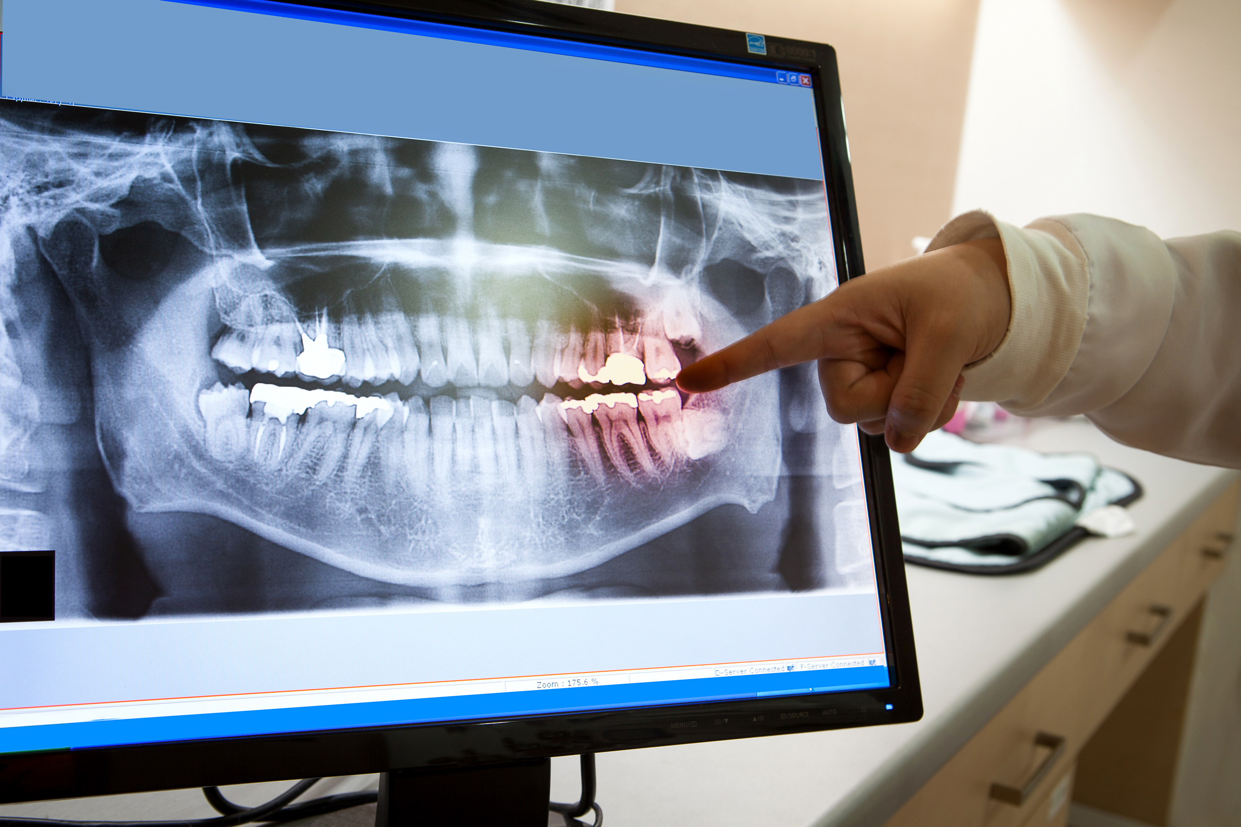 Oral x-ray