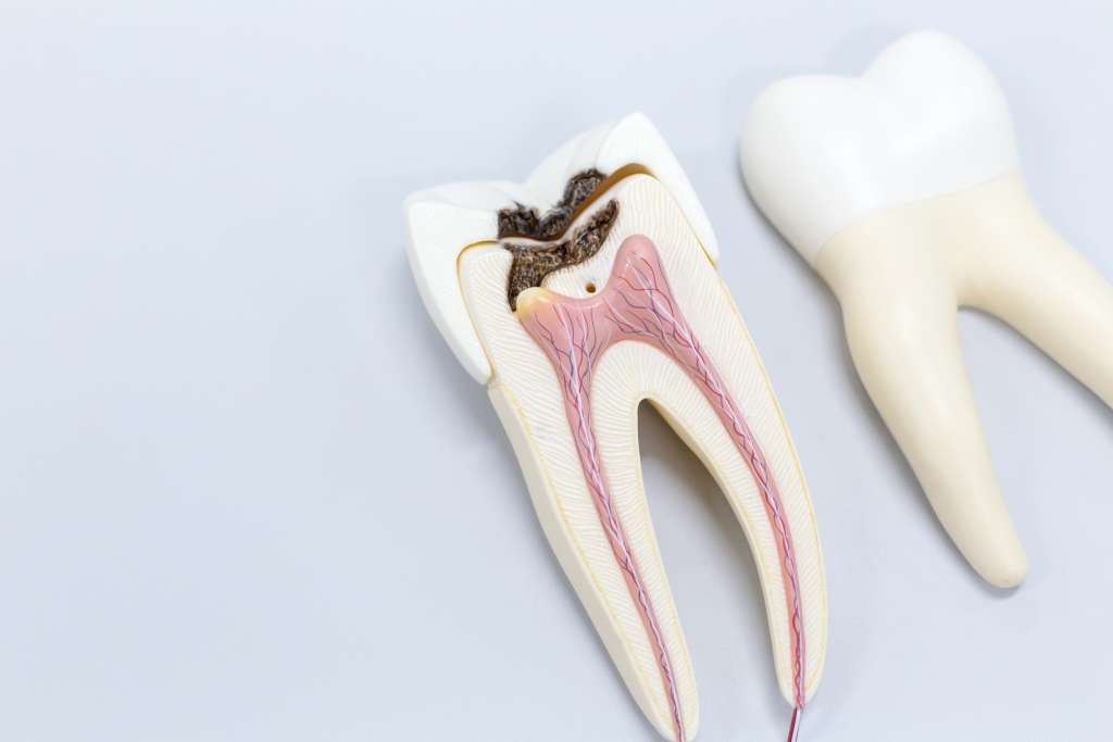 Root canal Model