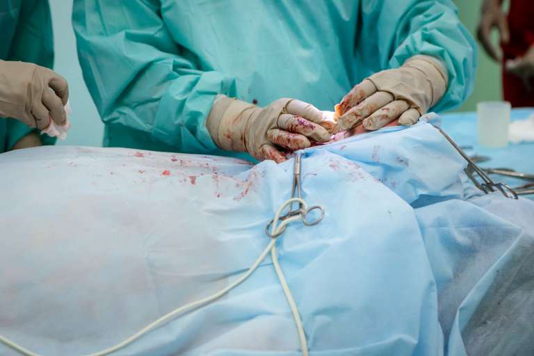 A photo of surgeon operating on a patient, to depict cosmetic surgery, in an article about Allergen Textured Breast Implants Recall.