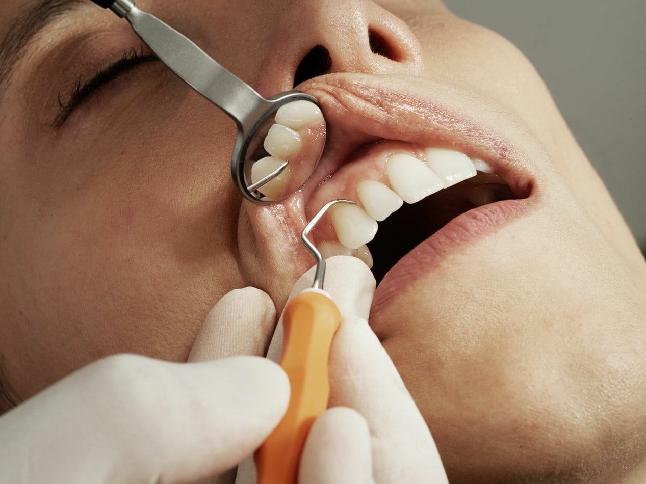 A photograph of a person having a dental check-up as a watchdog calls for the government to step in and save NHS dentistry from crisis