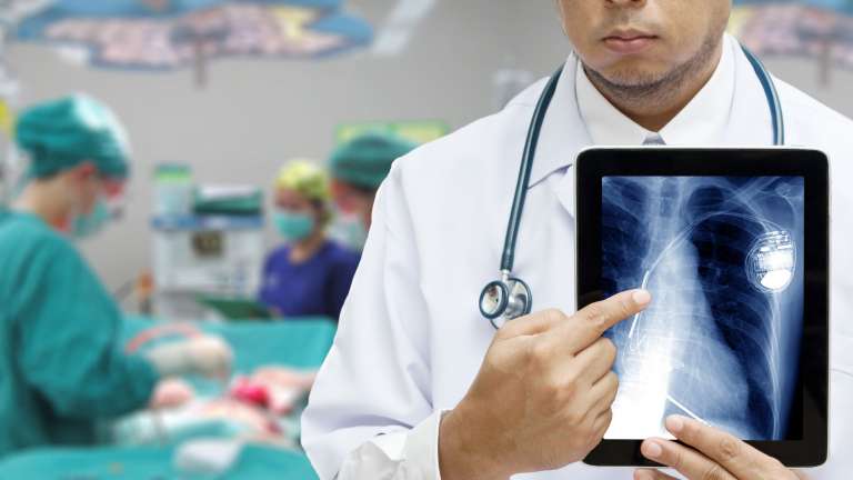 A doctor pointing to an image of an implanted pacemaker or defibrillator